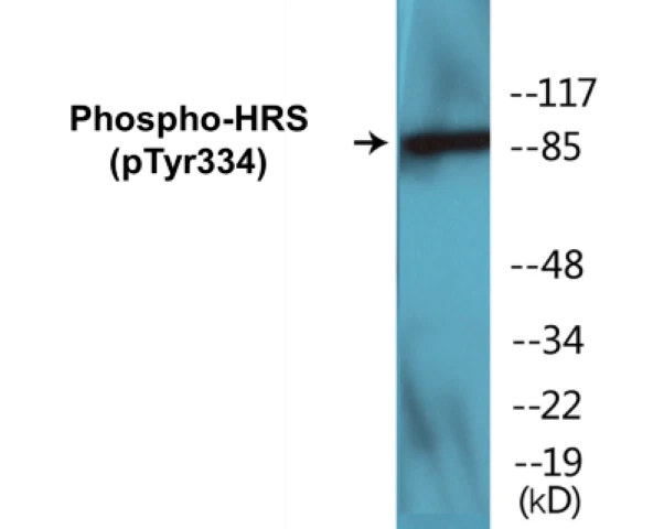 HRS (phospho Tyr334) Cell Based ELISA Kit (A102431-296)