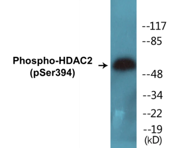 HDAC2 (phospho Ser394) Cell Based ELISA Kit (A102203-296)