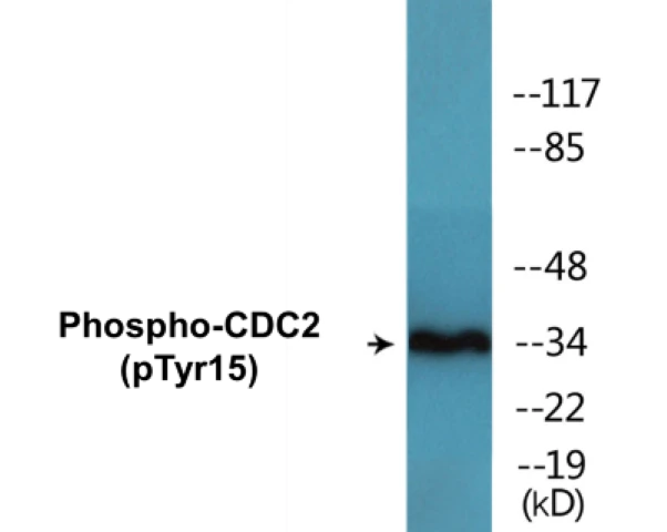 CDC2 (phospho Tyr15) Cell Based ELISA Kit (A102402-296)