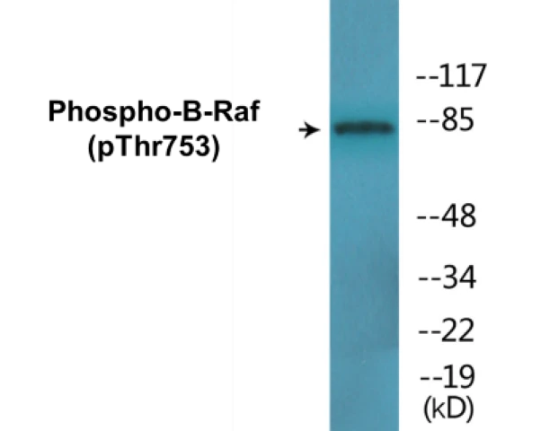 B-Raf (phospho Thr753) Cell Based ELISA Kit (A102217-296)