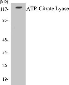 ATP-Citrate Lyase Cell Based ELISA Kit (A102818-96)