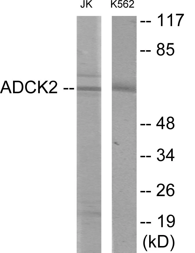 ADCK2 Cell Based ELISA Kit (A103703-96)