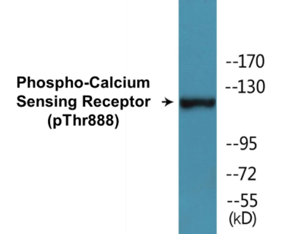 Calcium Sensing Receptor (phospho Thr888) Cell Based ELISA Kit (A102064-296)