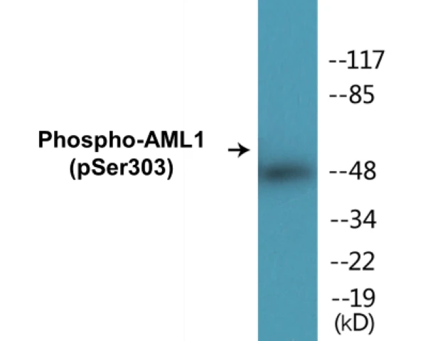 AML1 (phospho Ser303) Cell Based ELISA Kit (A102293-296)