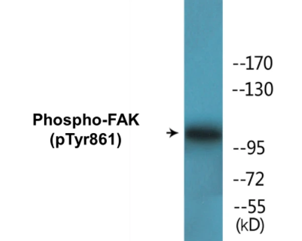 FAK (phospho Tyr861) Cell Based ELISA Kit (A102439-296)