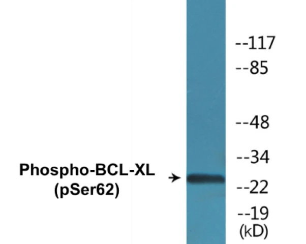 BCL-XL (phospho Ser62) Cell Based ELISA Kit (A102158-296)