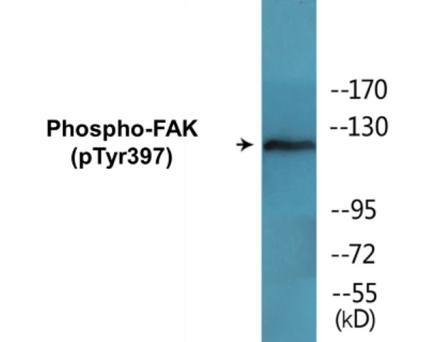 FAK (phospho Tyr397) Cell Based ELISA Kit (A102394-296)