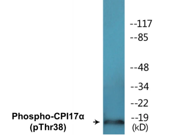 CPI17 alpha (phospho Thr38) Cell Based ELISA Kit (A102513-296)