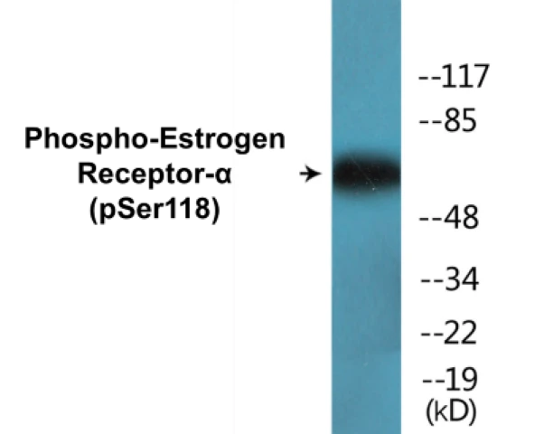 Estrogen Receptor alpha (phospho Ser118) Cell Based ELISA Kit (A102604-296)