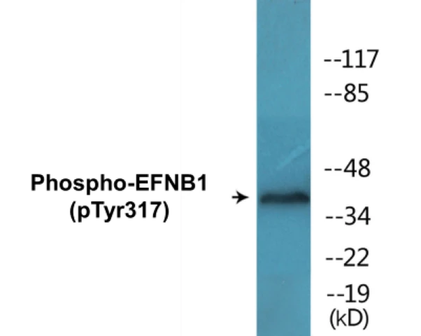 EFNB1 (phospho Tyr317) Cell Based ELISA Kit (A102182-296)