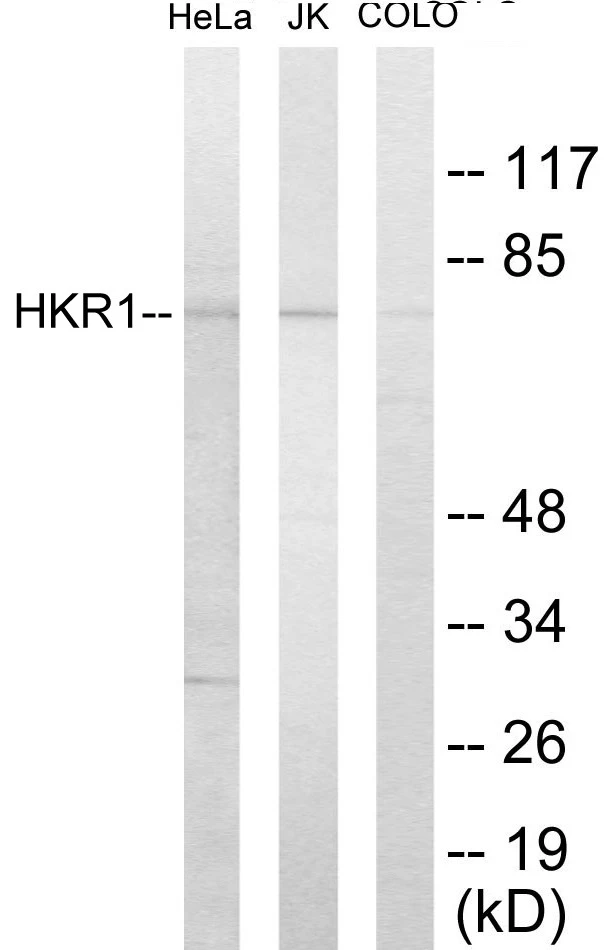 HKR1 Cell Based ELISA Kit (A103732-96)