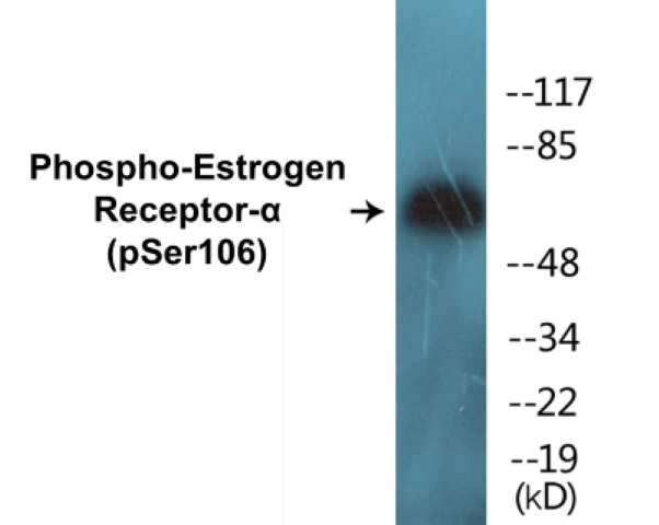 Estrogen Receptor alpha (phospho Ser106) Cell Based ELISA Kit (A102113-296)