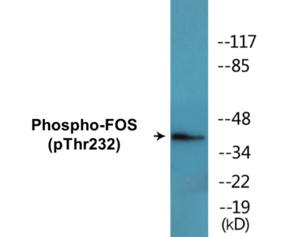 FOS (phospho Thr232) Cell Based ELISA Kit (A102452-296)