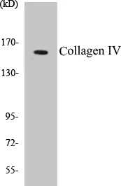 Collagen IV Cell Based ELISA Kit (A103370-96)