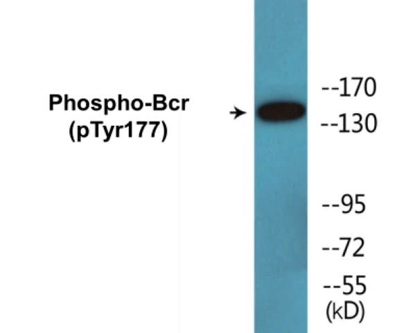 Bcr (phospho Tyr177) Cell Based ELISA Kit (A102673-296)