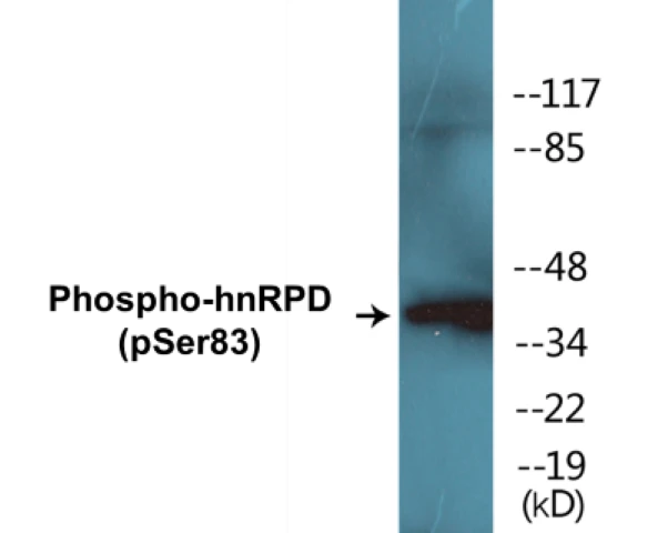 hnRPD (phospho Ser83) Cell Based ELISA Kit (A102315-296)