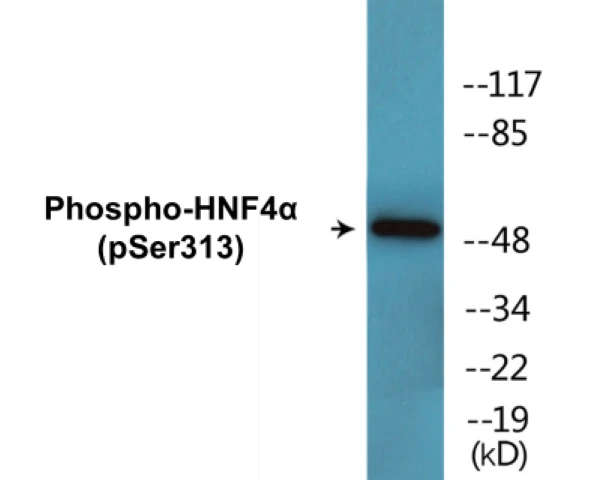 HNF4 alpha (phospho Ser313) Cell Based ELISA Kit (A102521-296)