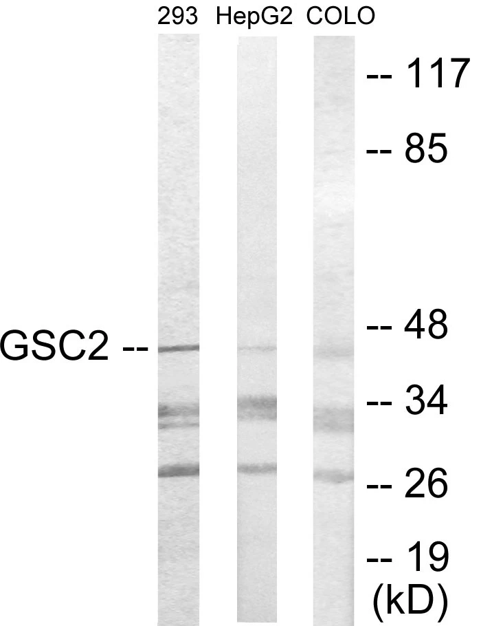 GSC2 Cell Based ELISA Kit (A103537-96)