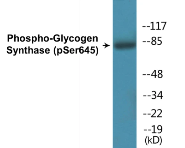 Glycogen Synthase (phospho Ser645) Cell Based ELISA Kit (A102066-296)