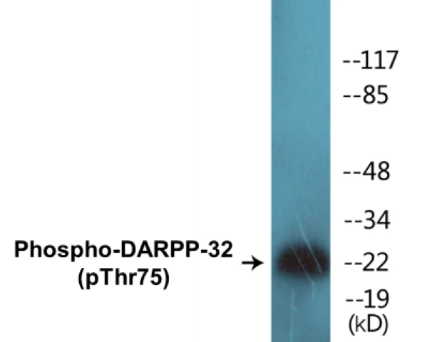 DARPP-32 (phospho Thr75) Cell Based ELISA Kit (A102049-296)