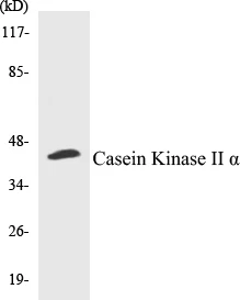 Casein Kinase II alpha Cell Based ELISA Kit (A102800-96)