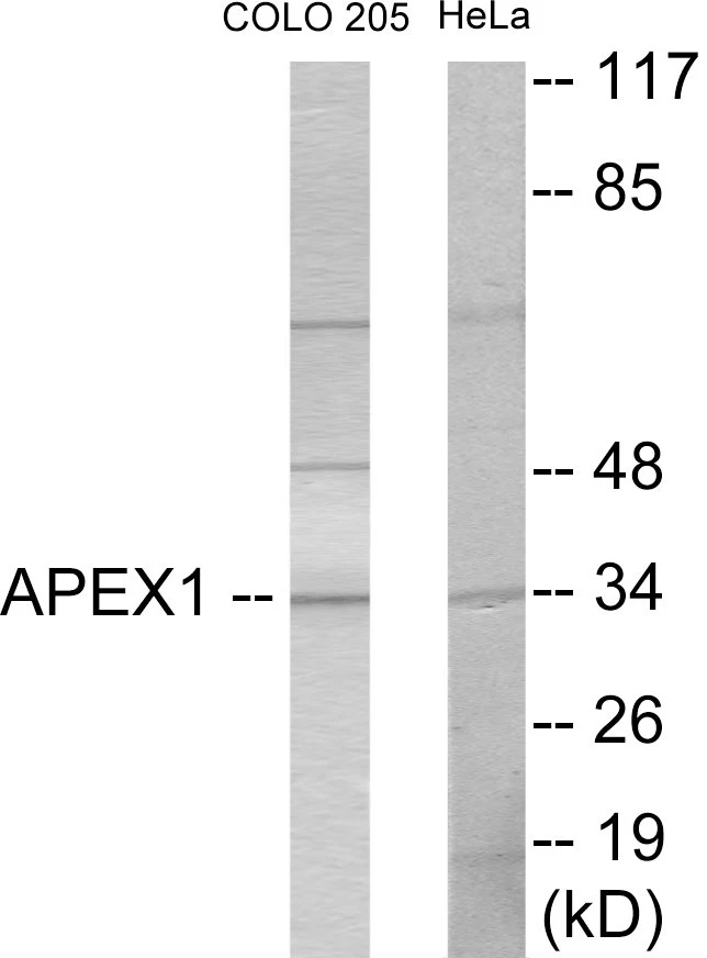 APEX1 Cell Based ELISA Kit (A103035-96)