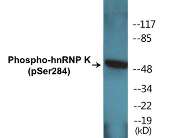 hnRNPK (phospho Ser284) Cell Based ELISA Kit (A102101-296)