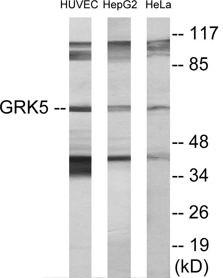 GRK5 Cell Based ELISA Kit (A103281-96)