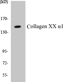 Collagen XX alpha 1 Cell Based ELISA Kit (A102807-96)