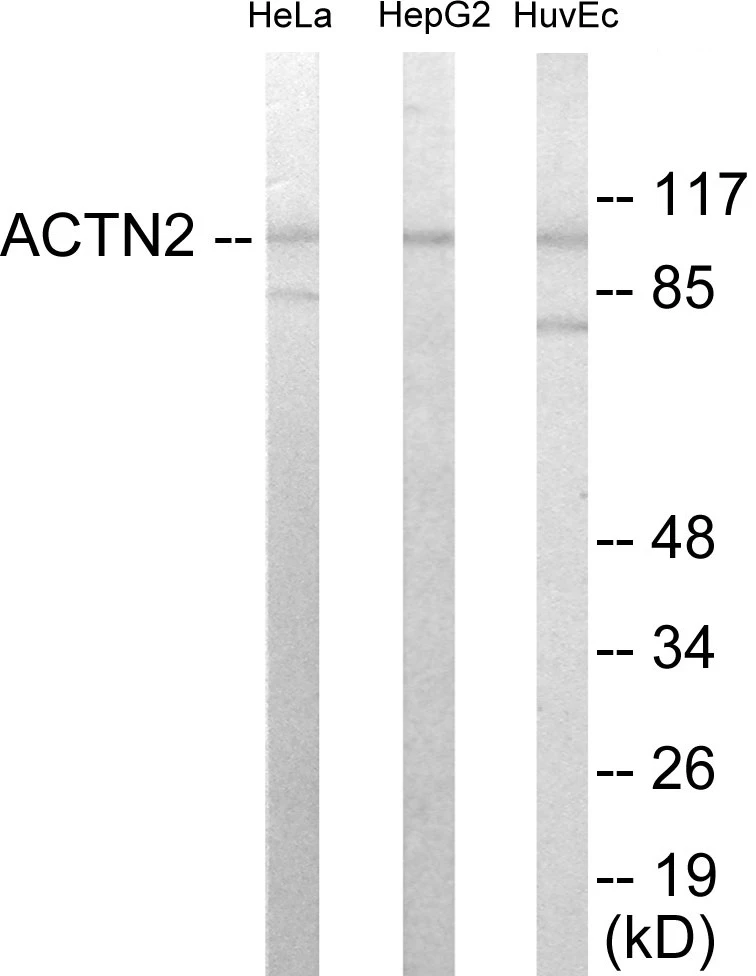 Actinin alpha 2 + 3 Cell Based ELISA Kit (A102809-96)