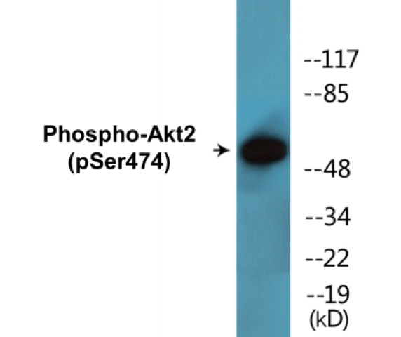 Akt2 (phospho Ser474) Cell Based ELISA Kit (A102323-296)