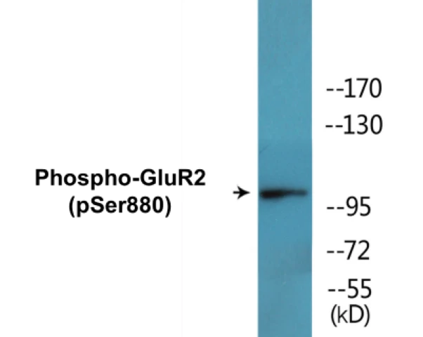 GluR2 (phospho Ser880) Cell Based ELISA Kit (A102202-296)