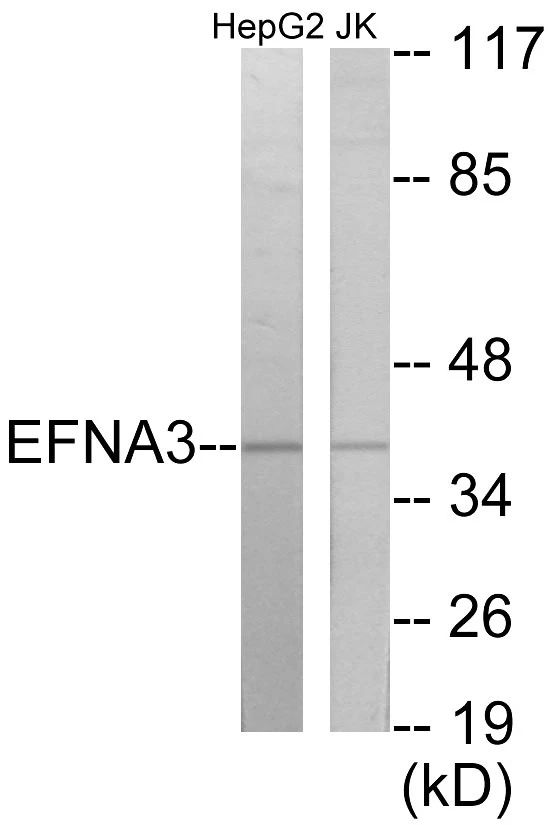 EFNA3 Cell Based ELISA Kit (A103152-96)