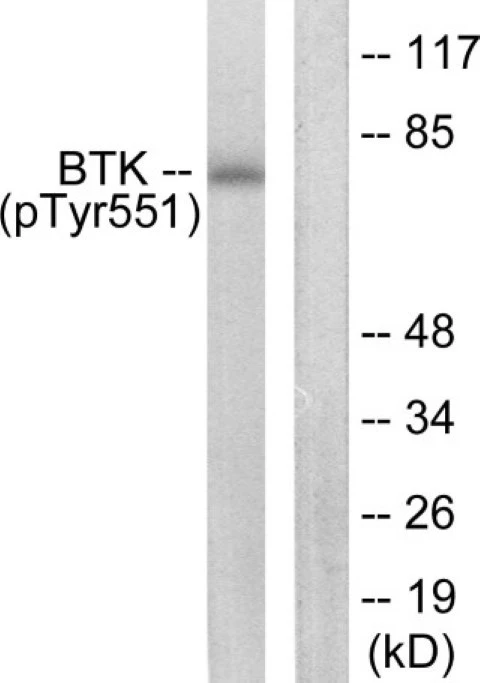 BTK (phospho Tyr551) Cell Based ELISA Kit (A103821-296)