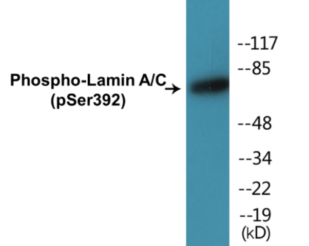 Lamin A + C (phospho Ser392) Cell Based ELISA Kit (A102500-296)