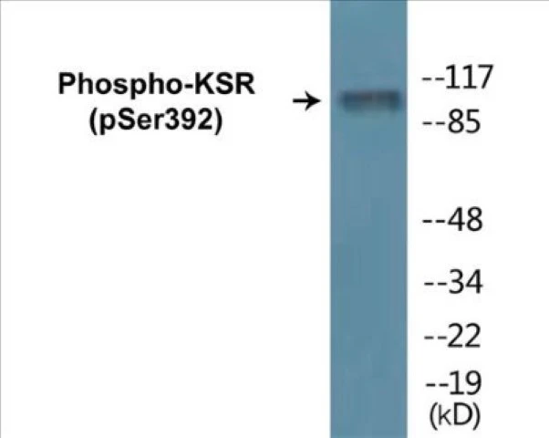 KSR (phospho Ser392) Cell Based ELISA Kit (A102666-296)