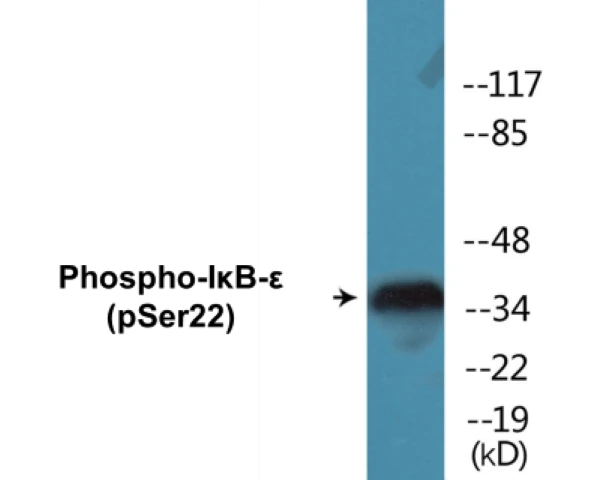 IkB epilson (phospho Ser22) Cell Based ELISA Kit (A102515-296)