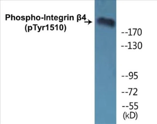 Integrin beta 4 (phospho Tyr1510) Cell Based ELISA Kit (A102116-296)