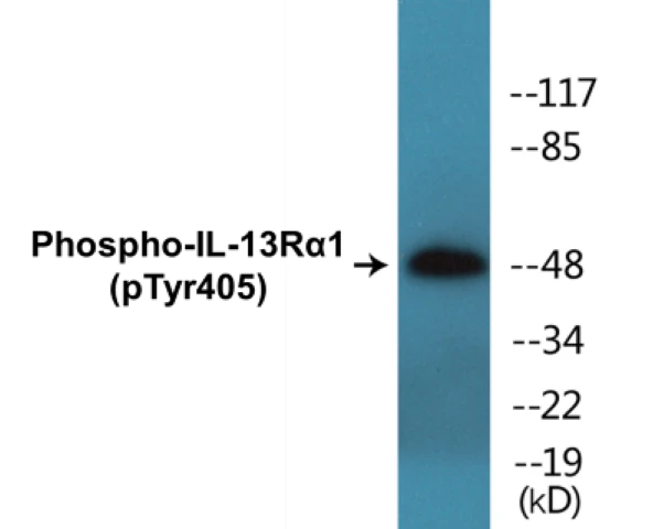 IL-13R alpha 1 (phospho Tyr405) Cell Based ELISA Kit (A102371-296)