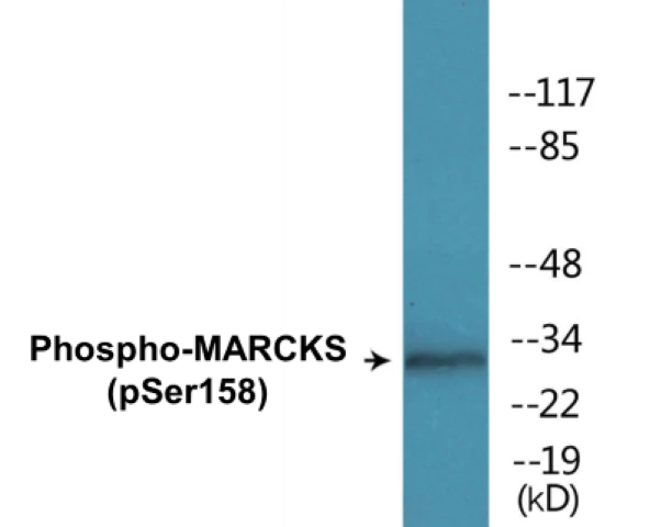 MARCKS (phospho Ser158) Cell Based ELISA Kit (A102103-296)