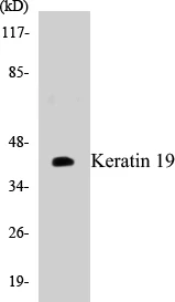 Keratin 19 Cell Based ELISA Kit (A102894-96)