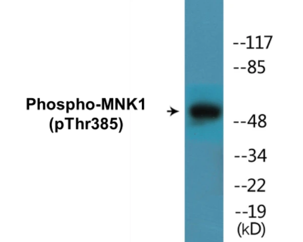 MNK1 (phospho Thr385) Cell Based ELISA Kit (A102357-296)