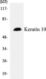 Keratin 10 Cell Based ELISA Kit (A102871-96)