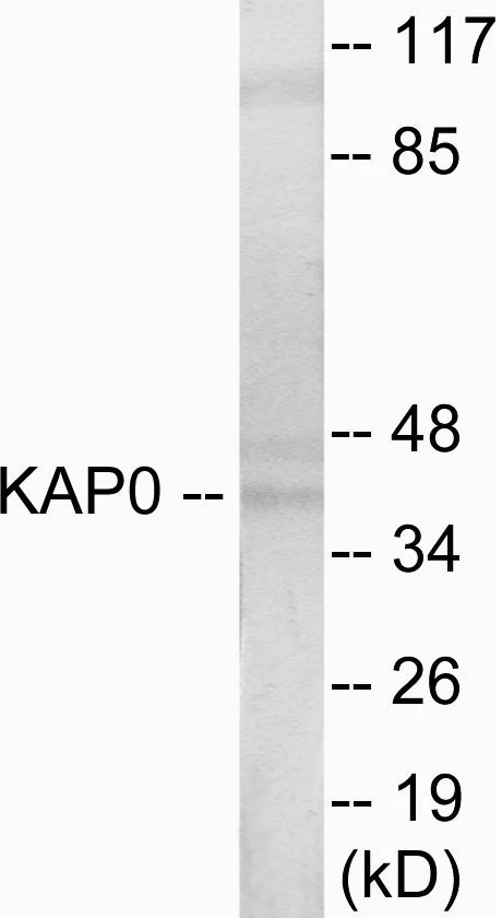 KAP0 Cell Based ELISA Kit (A103273-96)