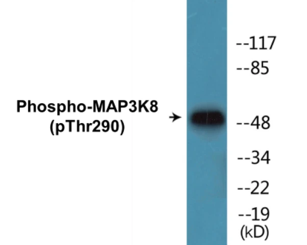 MAP3K8 (phospho Thr290) Cell Based ELISA Kit (A102092-296)