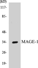 MAGE-1 Cell Based ELISA Kit (A103644-96)