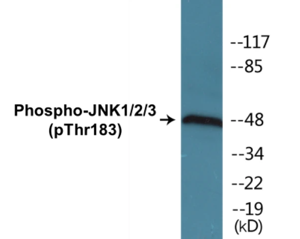 JNK1 + 2 + 3 (phospho Thr183) Cell Based ELISA Kit (A102493-296)