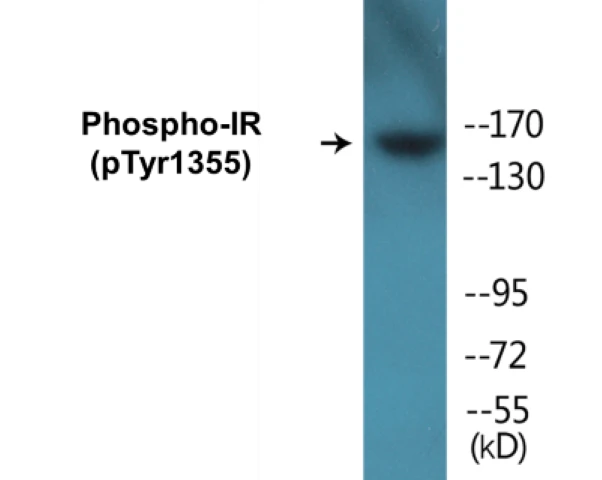 IR (phospho Tyr1355) Cell Based ELISA Kit (A102755-296)