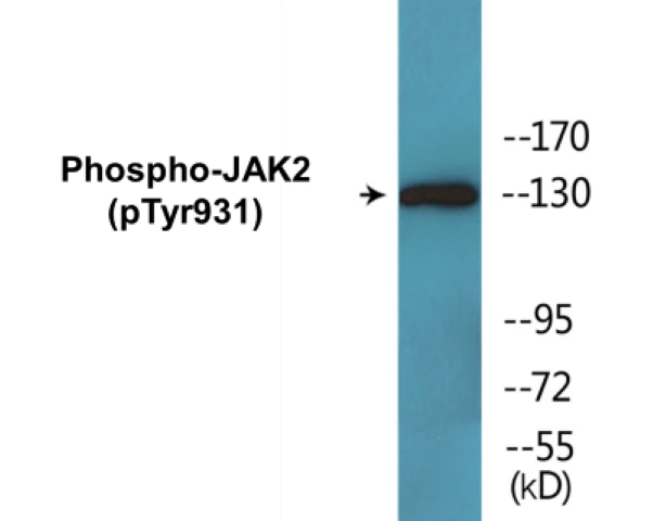 JAK2 (phospho Tyr931) Cell Based ELISA Kit (A102348-296)