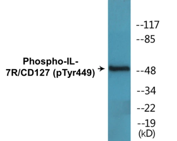 IL-7R (phospho Tyr449) Cell Based ELISA Kit (A102624-296)